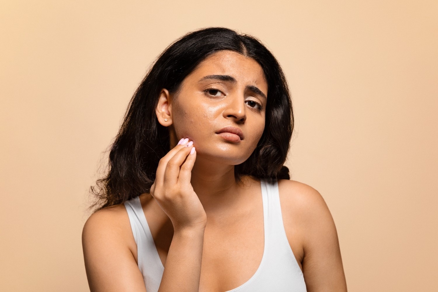 Uneven Skin Tone and Dullness