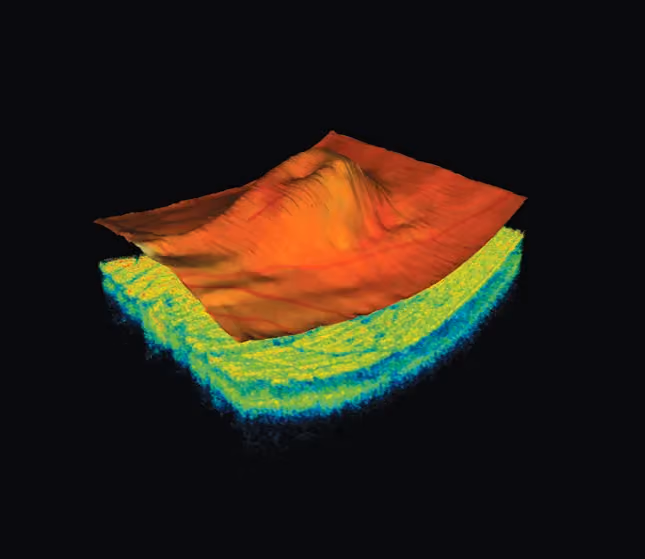 OCT scanning equipment at David Burghardt Vision Care