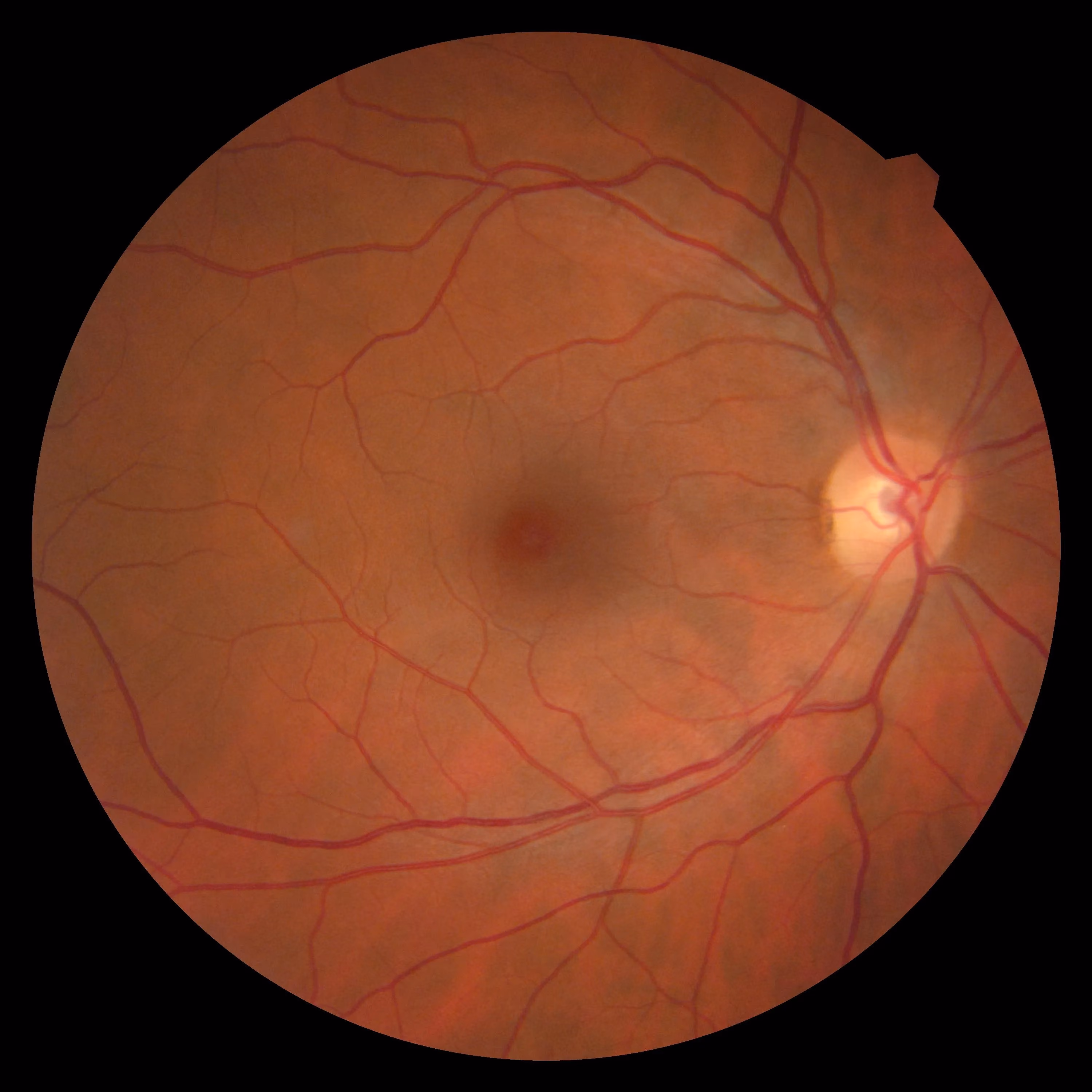 Optomap retinal imaging at David Burghardt Vision Care
