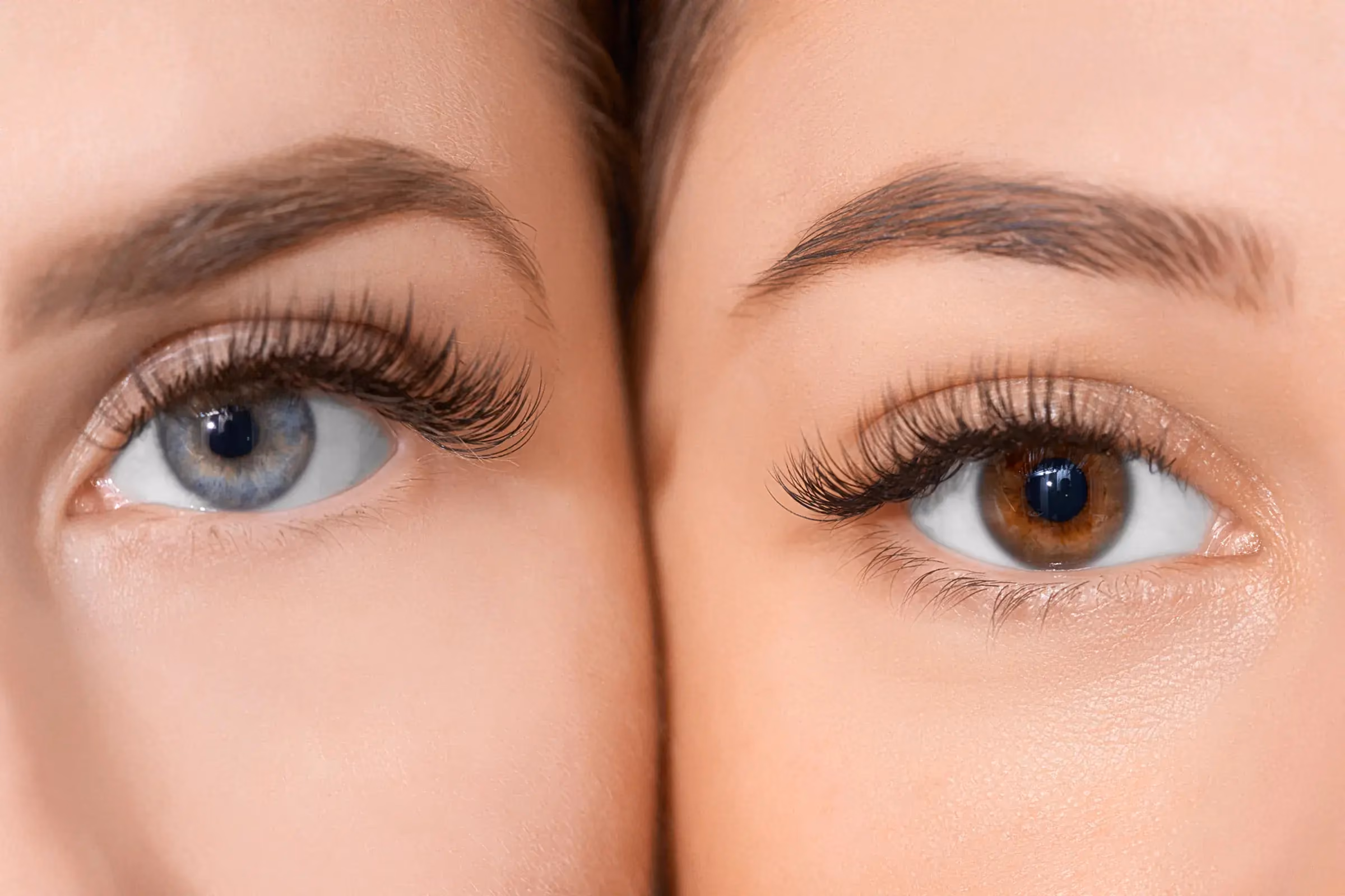 Blepharitis