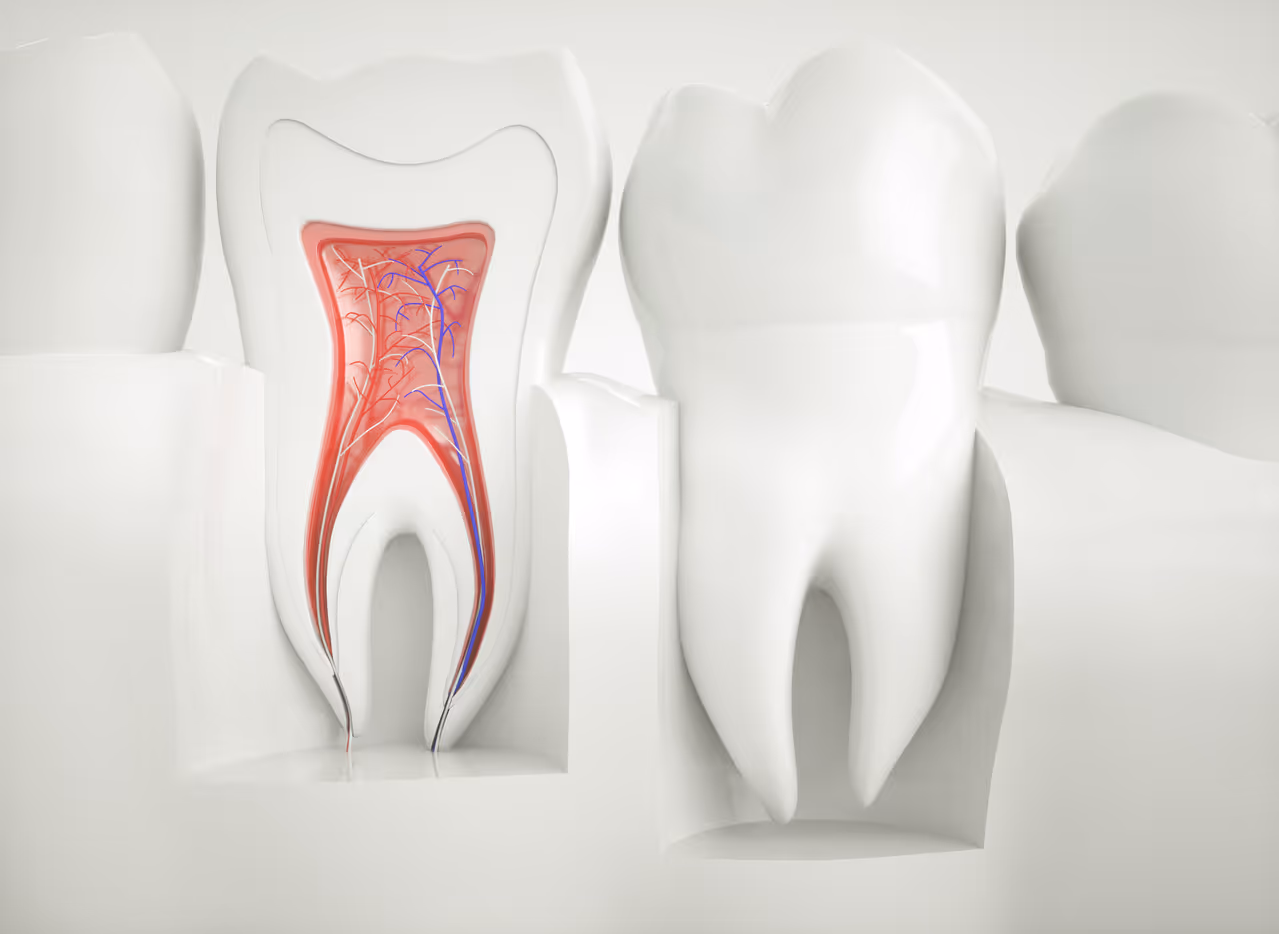 Root Canal vs. Tooth Extraction: Which Is Right for You?