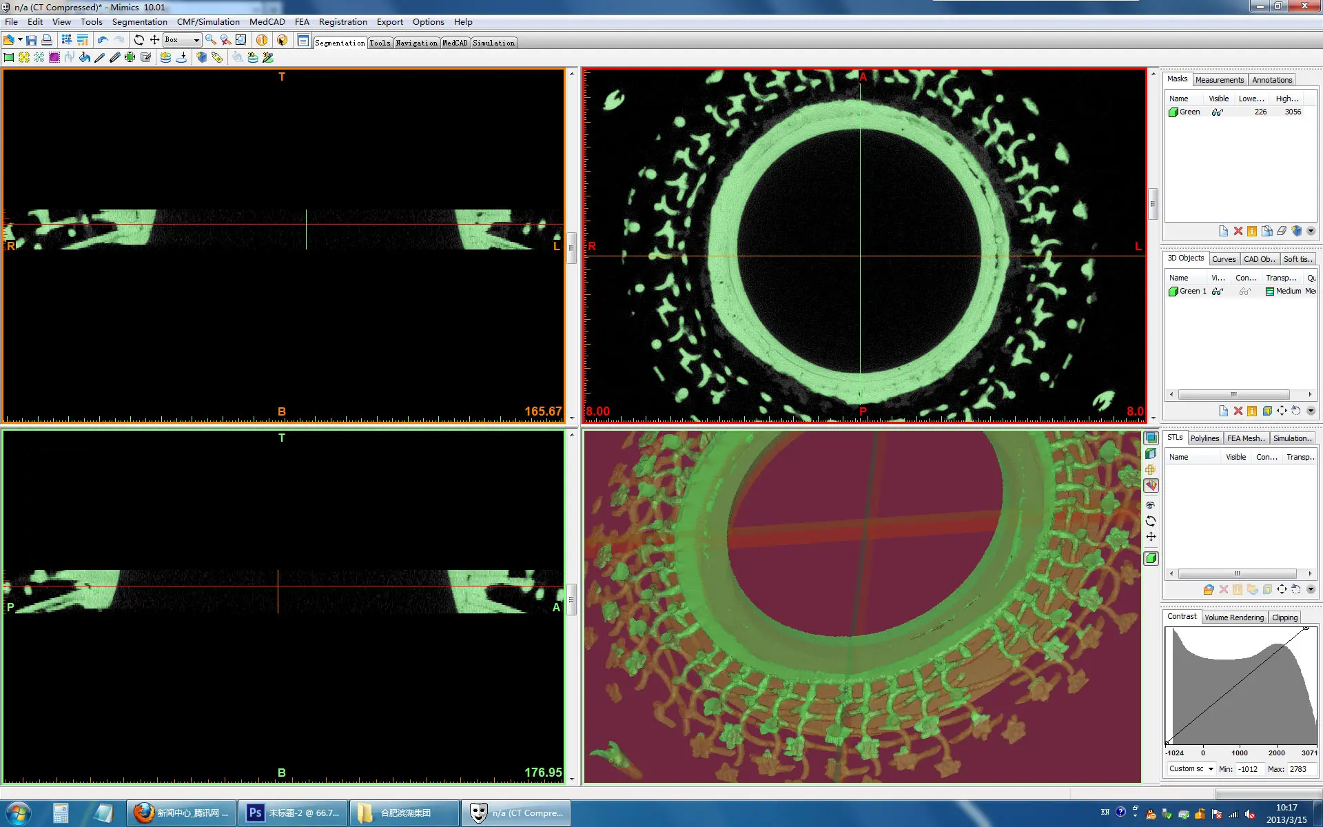 A digital reconstruction interface aligning scan sections and reconstructed geometry.