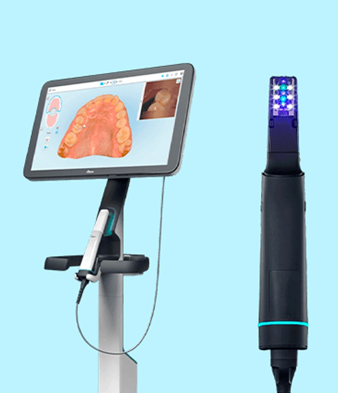 Tecnologia digitale per la scansione dentale
