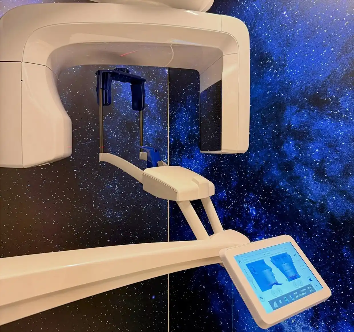 Scanner digitale per la progettazione di trattamenti dentali