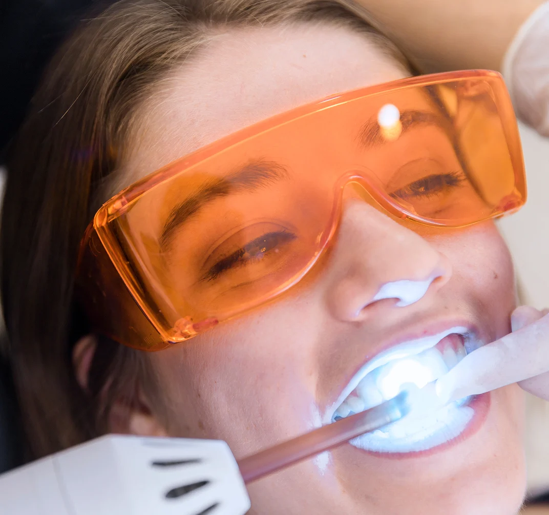Trattamenti odontoiatrici per un sorriso