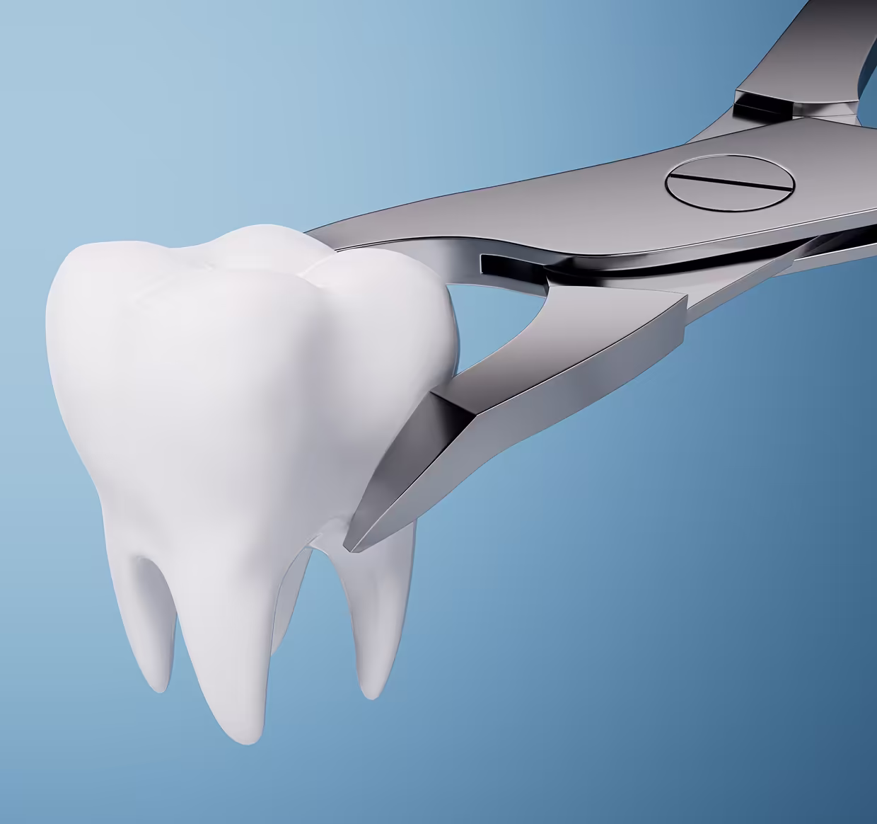 Estrazione dentale sicura e indolore