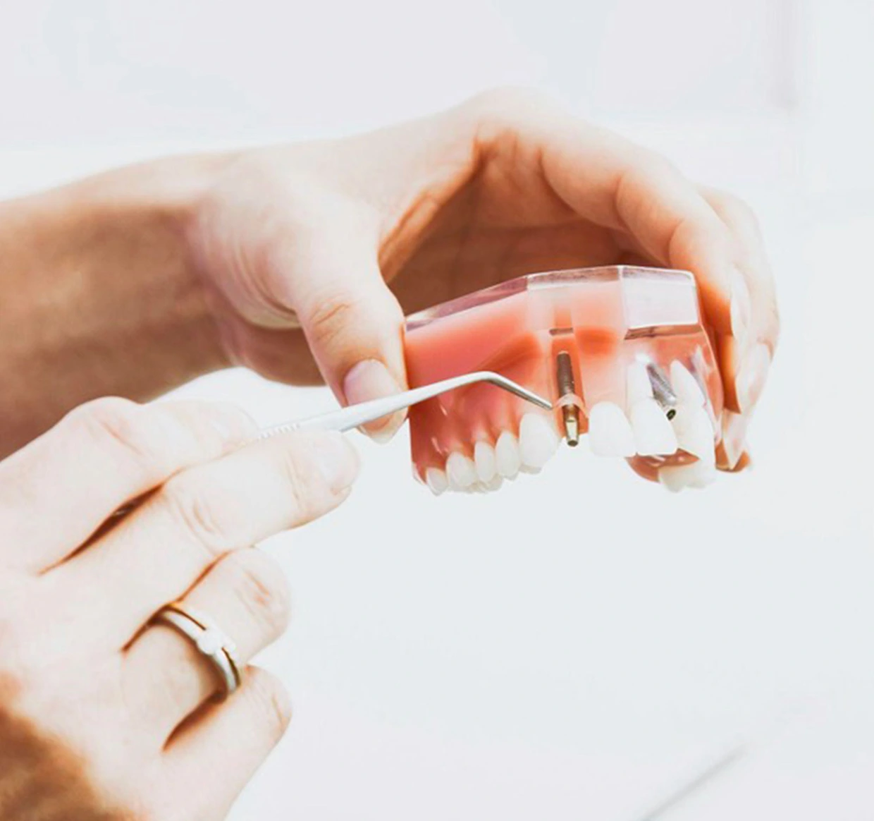 Dentista che applica un apparecchio ortodontico