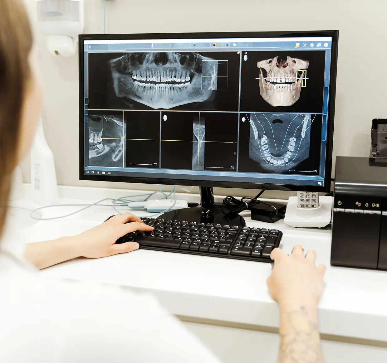Dentista che esamina immagini radiografiche dei denti