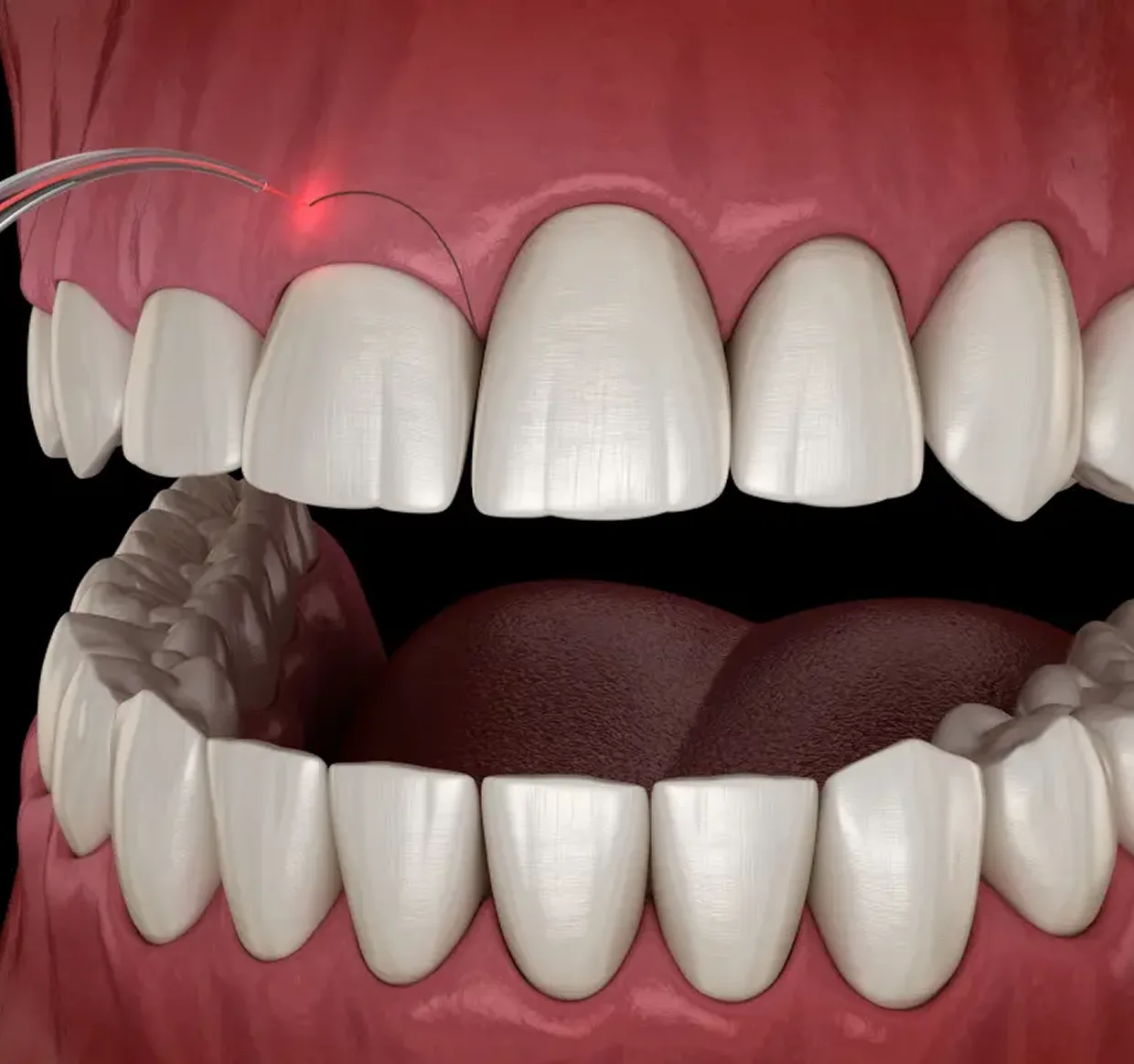Denti sani in primo piano, modello