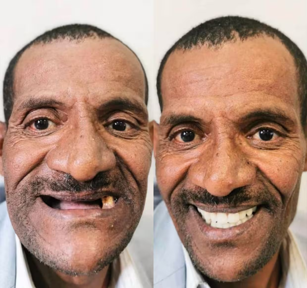 Il risultato del lavoro del dentista
