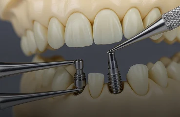 Primo piano degli impianti