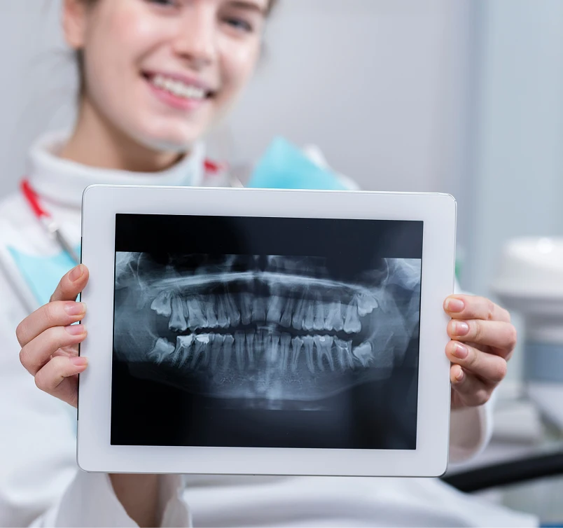 Paziente che mostra una radiografia panoramica dentale