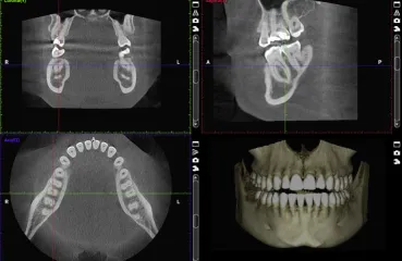 Esame radiologico dentale CBCT