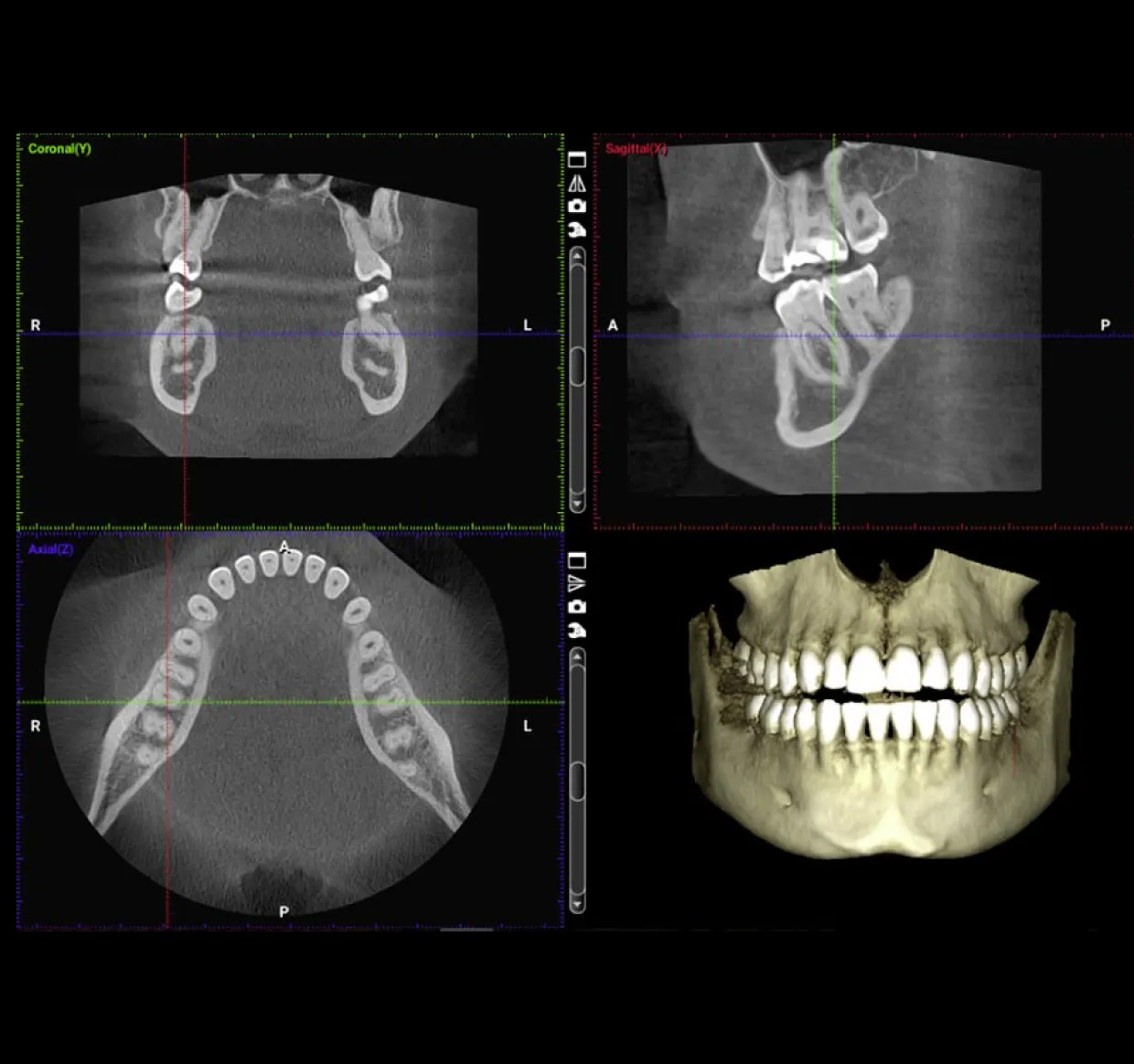 Esame CBCT con immagini dentali tridimensionali