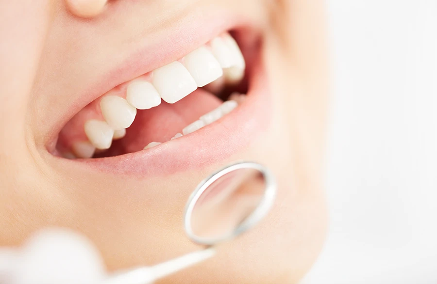 Close-up of a smiling mouth with clean white teeth and a dental mirror near the lower lip.