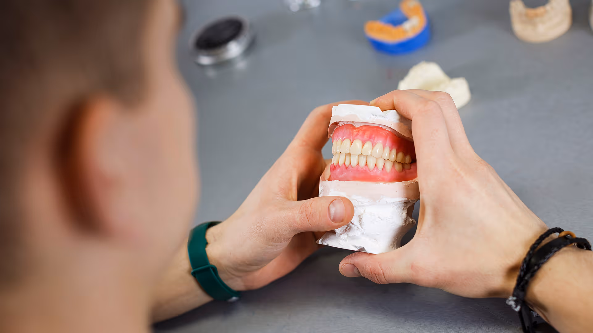 All-On-X vs Traditional Dentures: Which Is Right For You in 2026?
