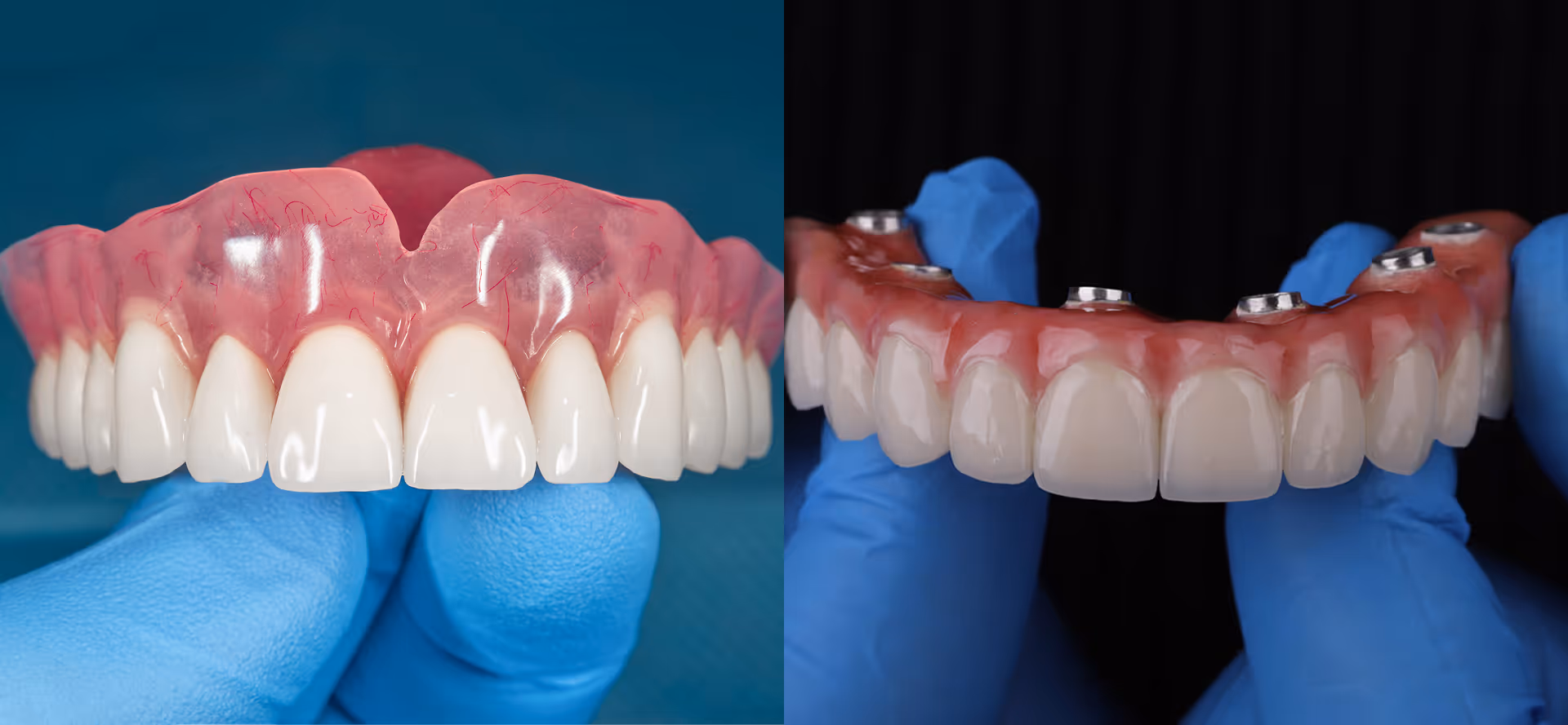 Side-by-side comparison of traditional dentures and All-On-X dental implants at Arvada Dental Center & Implants in Arvada, CO
