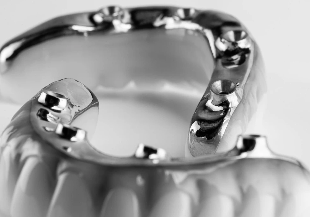 What Are The Components Of Full Mouth Dental Implants?