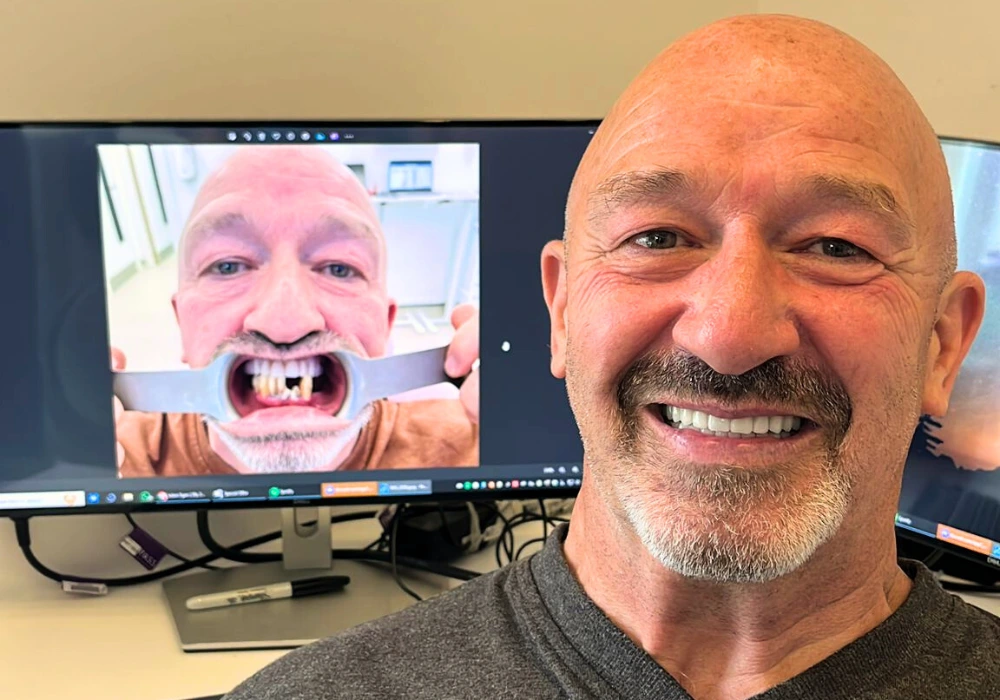 Can You Have Dental Implants With Receding Gums?