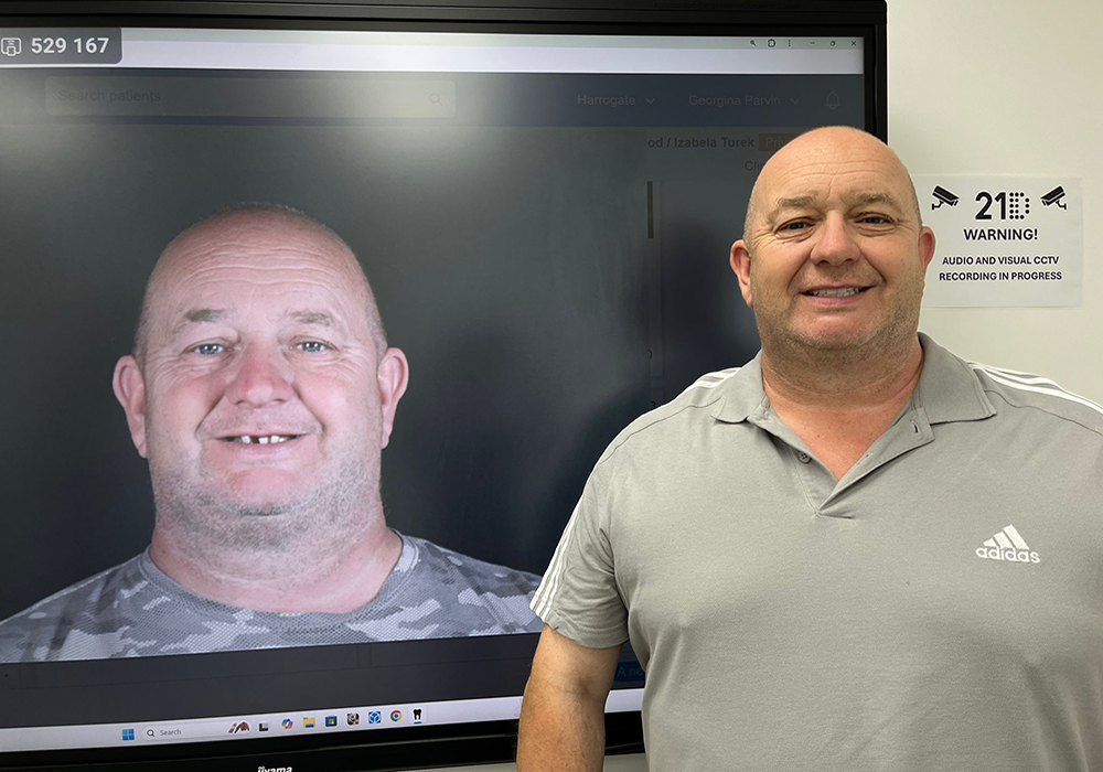 Fulll Jaw Implants | 21D Patient Story - Paul
