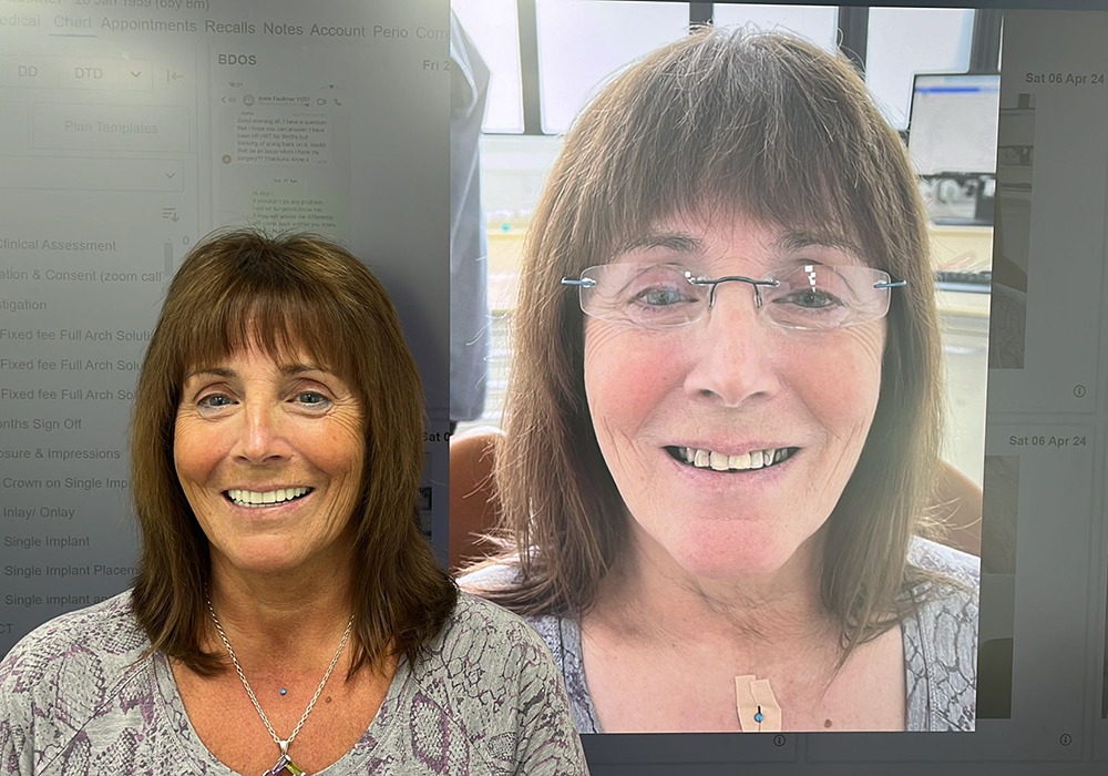 21D Patient Story - Anne