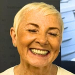 all on 4 dental implants testimonial
