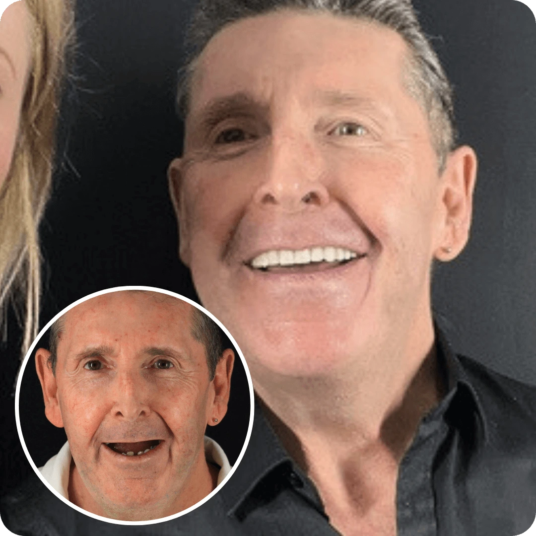 how much for a full set of dental implants uk
