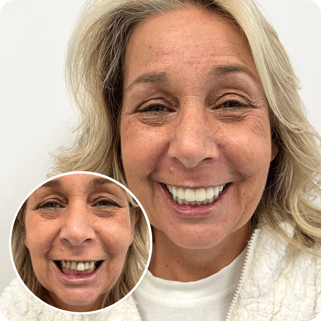 evodental before and after