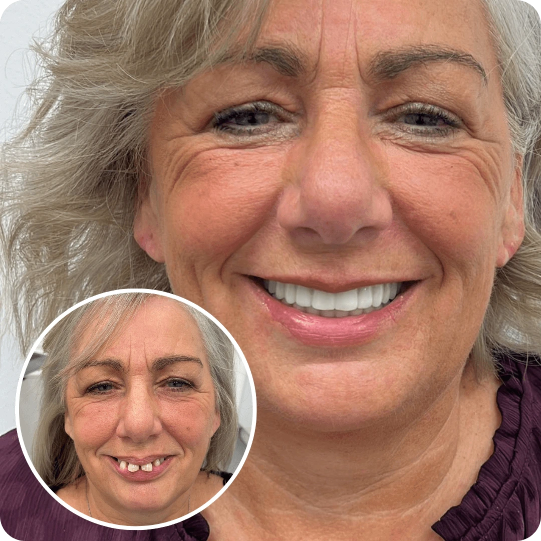 evo dental before and after