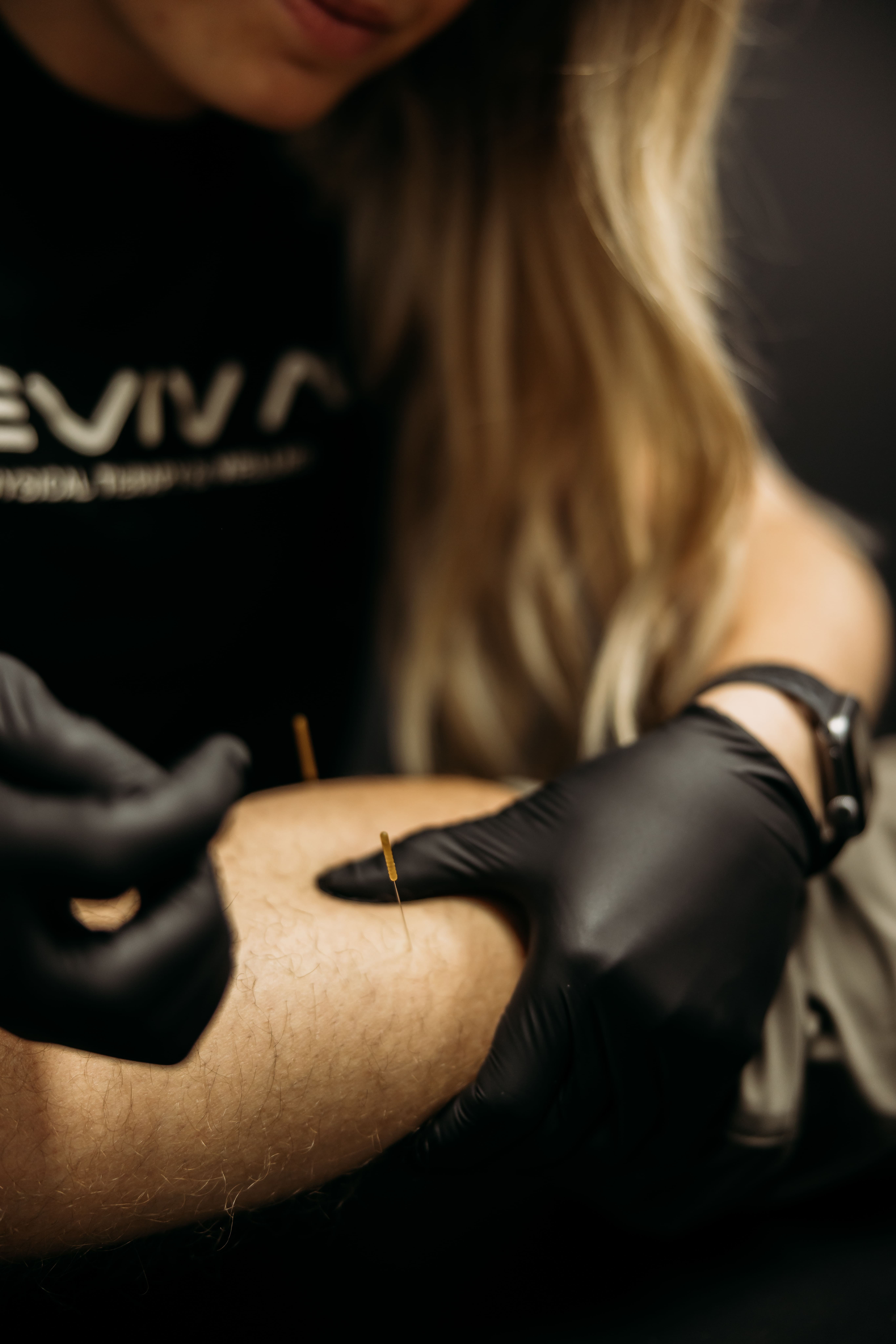 Close-up of a specialist wearing black gloves applying a dry needling needle to a patient's leg during a physical therapy session