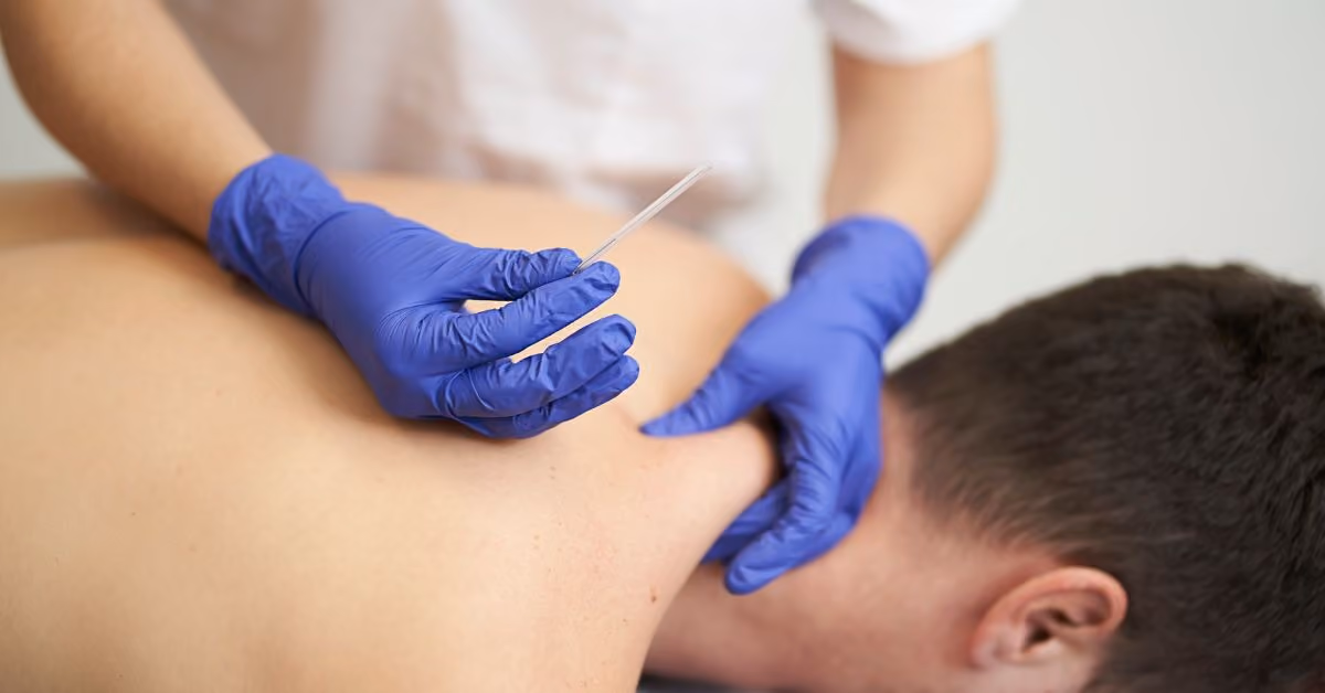 does dry needling hurt