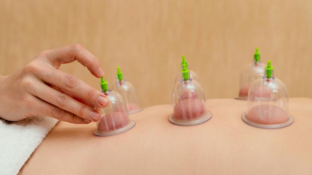 How Cupping Works