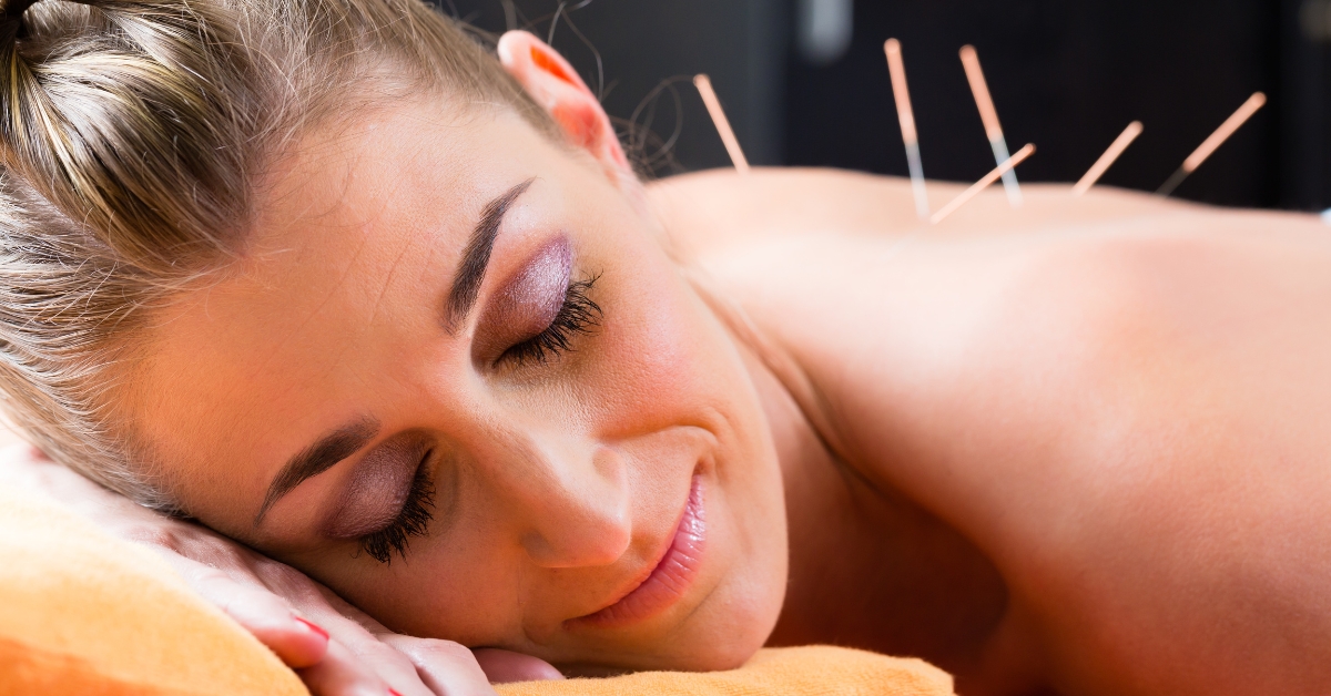 how does dry needling work