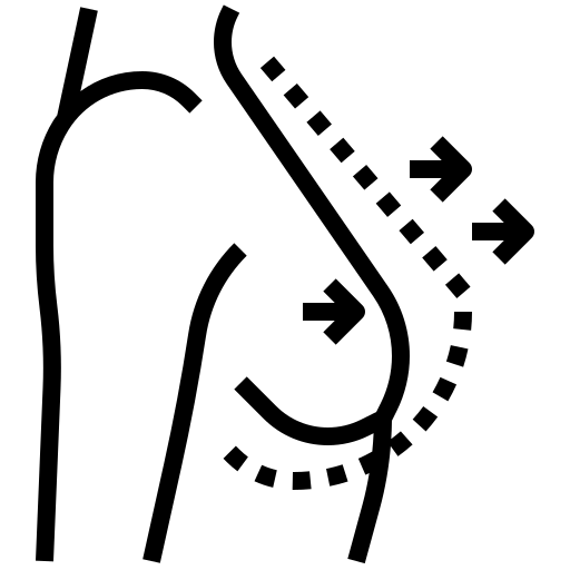 Illustration showing a female breast lift surgery