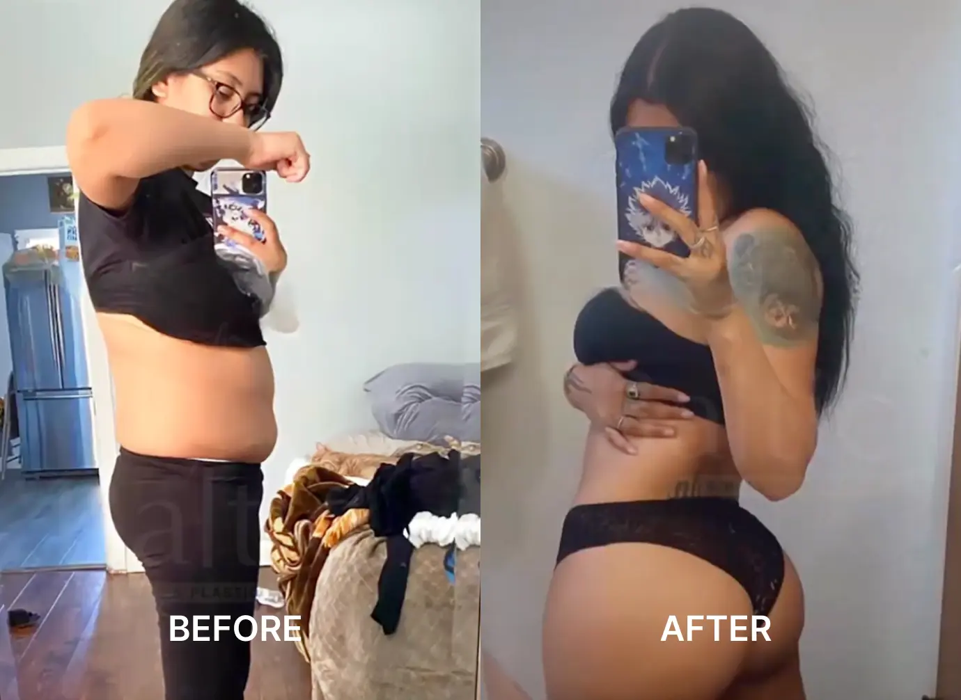 Side-by-side before and after photos of a woman showing weight loss and body transformation.