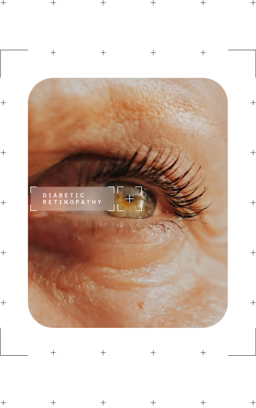 Close-up of an elderly person's eye with text overlay reading diabetic retinopathy.
