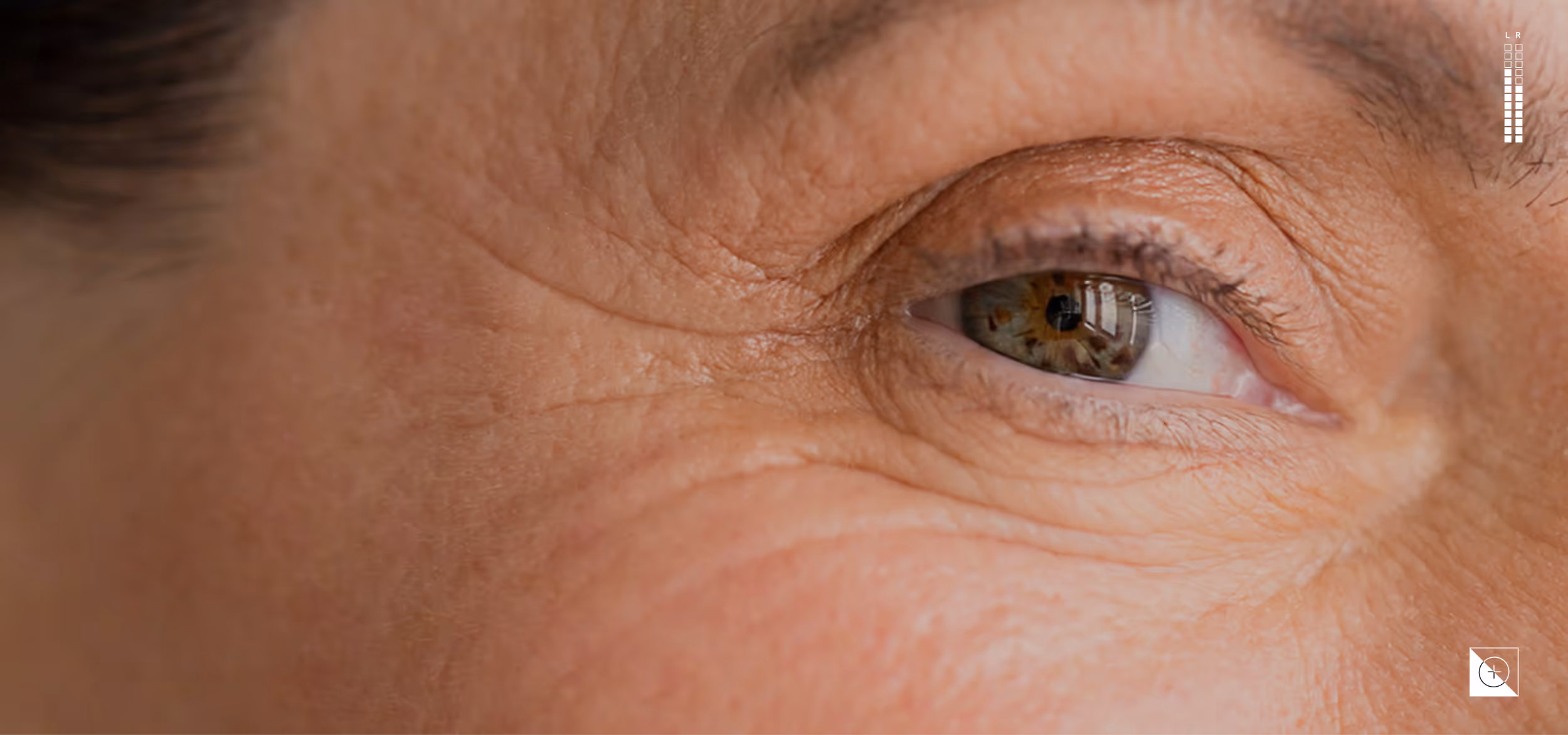 Close-up of a light brown eye with detailed skin texture and wrinkles around the eye.
