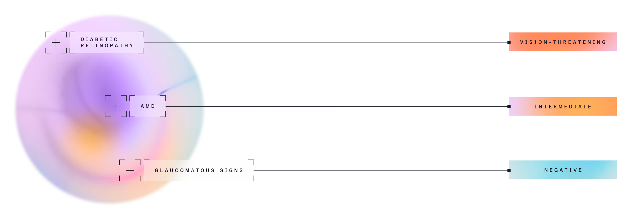 Eye image labeled with diabetic retinopathy as vision-threatening, AMD as intermediate, and Glaucomatous signs as negative.