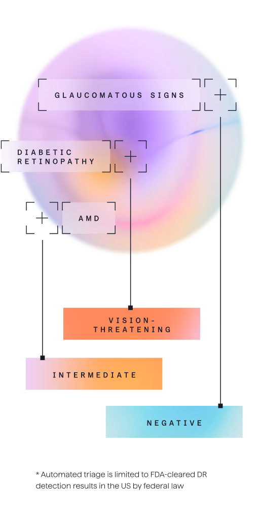 Eye image labeled with diabetic retinopathy as vision-threatening, AMD as intermediate, and Glaucomatous signs as negative. Also a disclaimer that automated triage is limited to FDA-cleared DR detection results in the US by federal law.