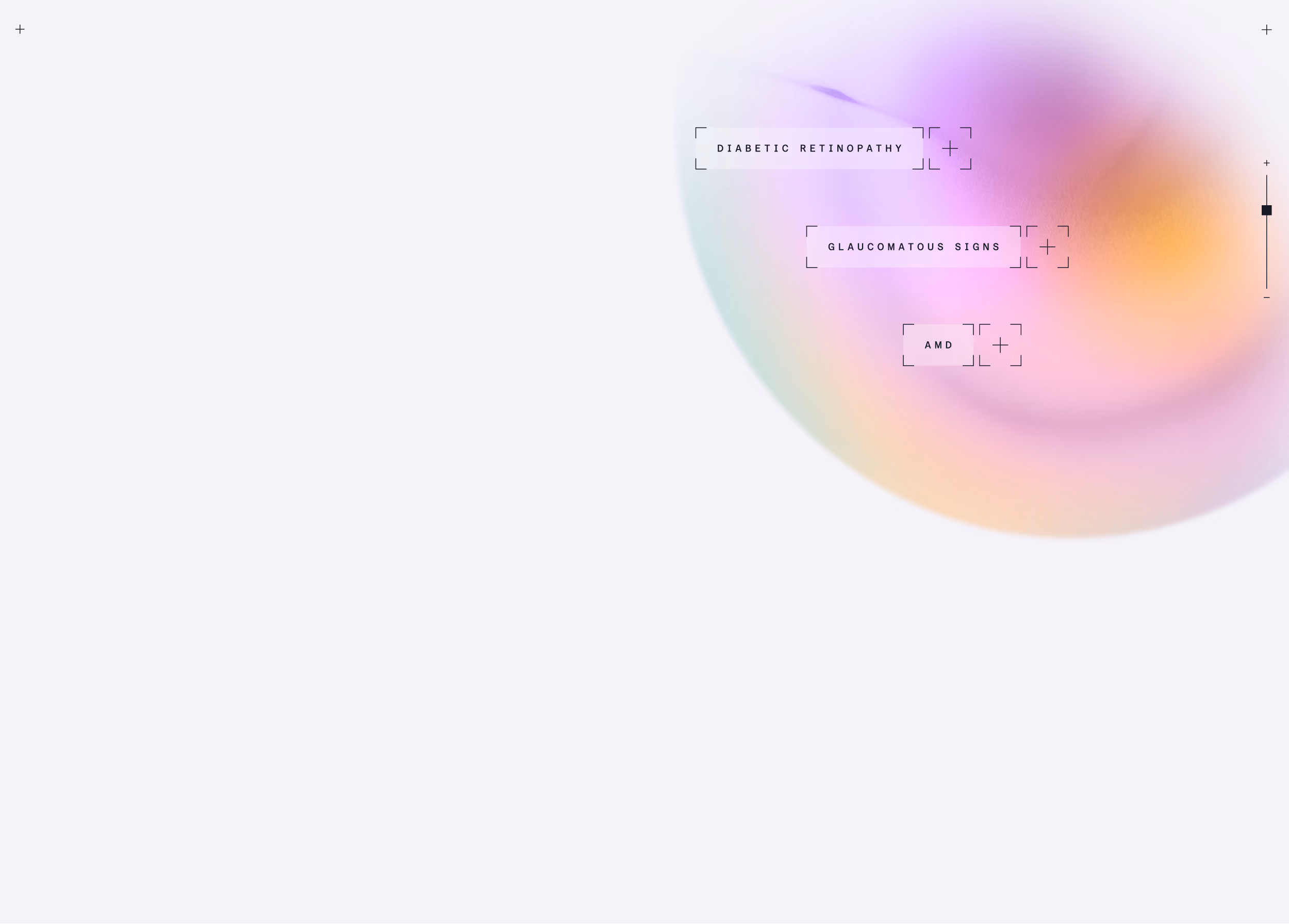 Abstract colorful circular design with text labels 'Diabetic Retinopathy', 'Glaucomatous Signs', and 'AMD' on a light background.
