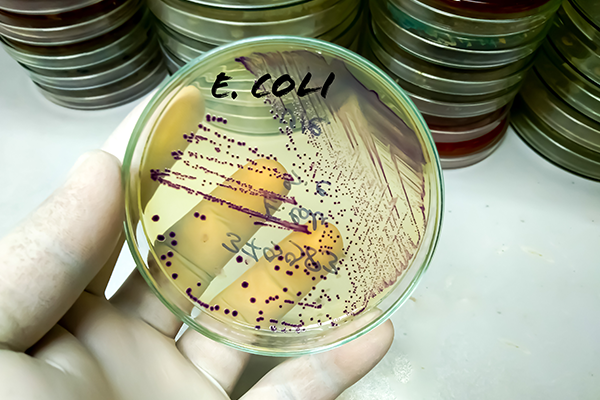 E. COLI OUTBREAK LEGAL REPRESENTATION