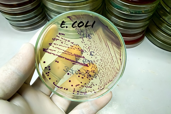 E. COLI OUTBREAK LEGAL REPRESENTATION