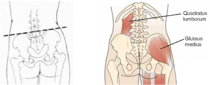 Diagram showing the gluteus medius and quadratus lumborum muscles with labeled text. The left side depicts pelvic alignment.