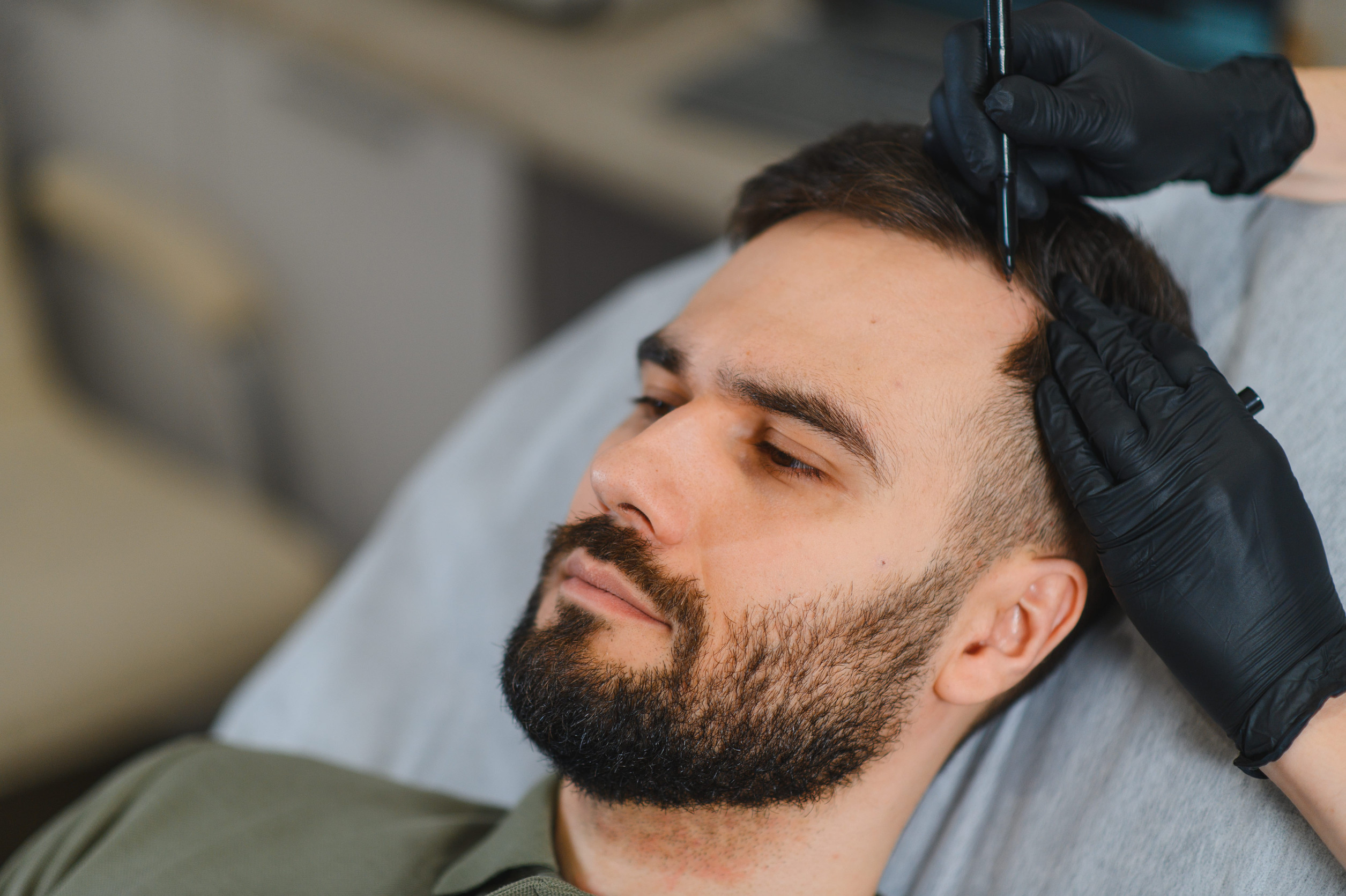 Un uomo che si è da poco sottoposto ad un trapianto di capelli