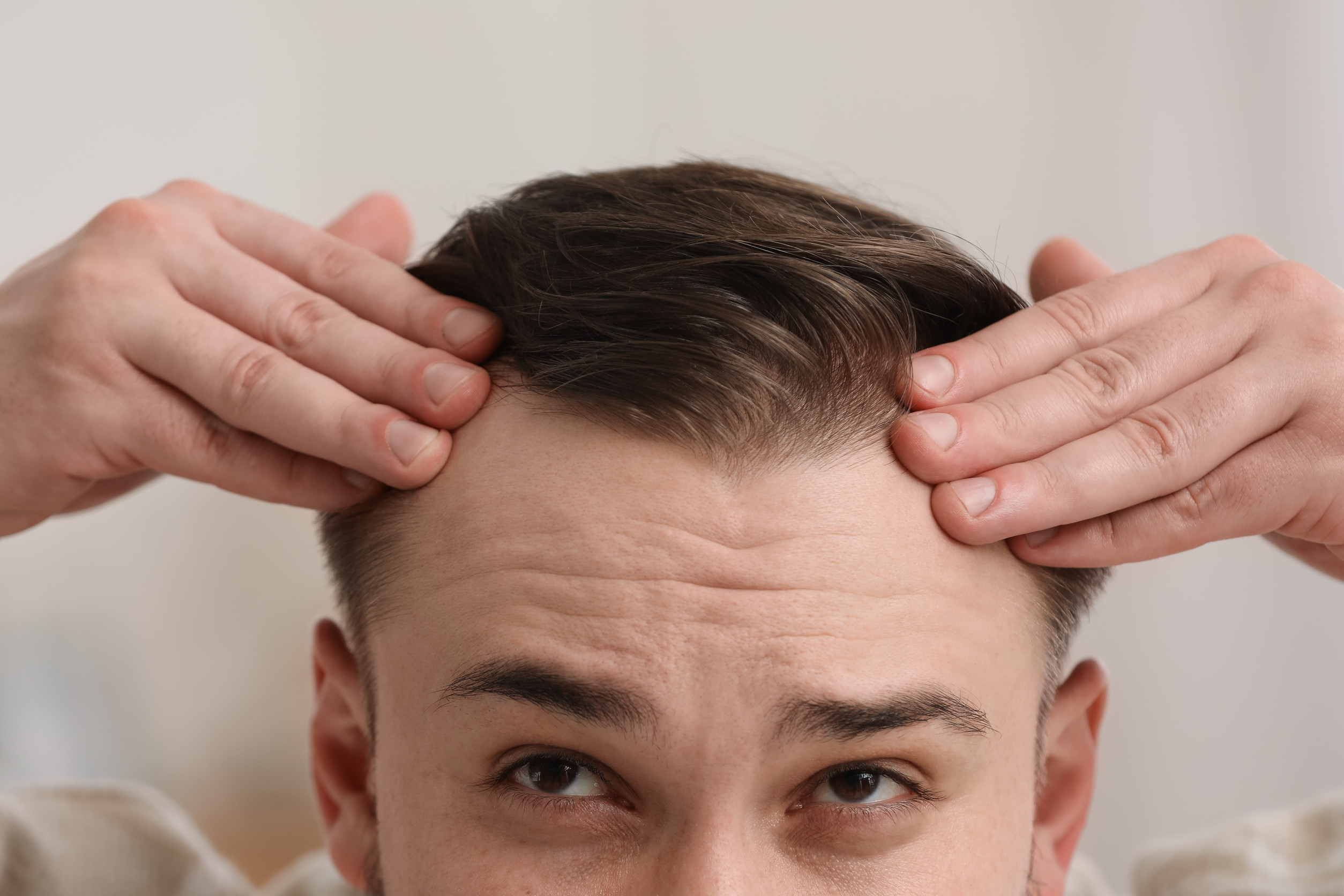 Un uomo si controlla in una fase post trapianto di capelli