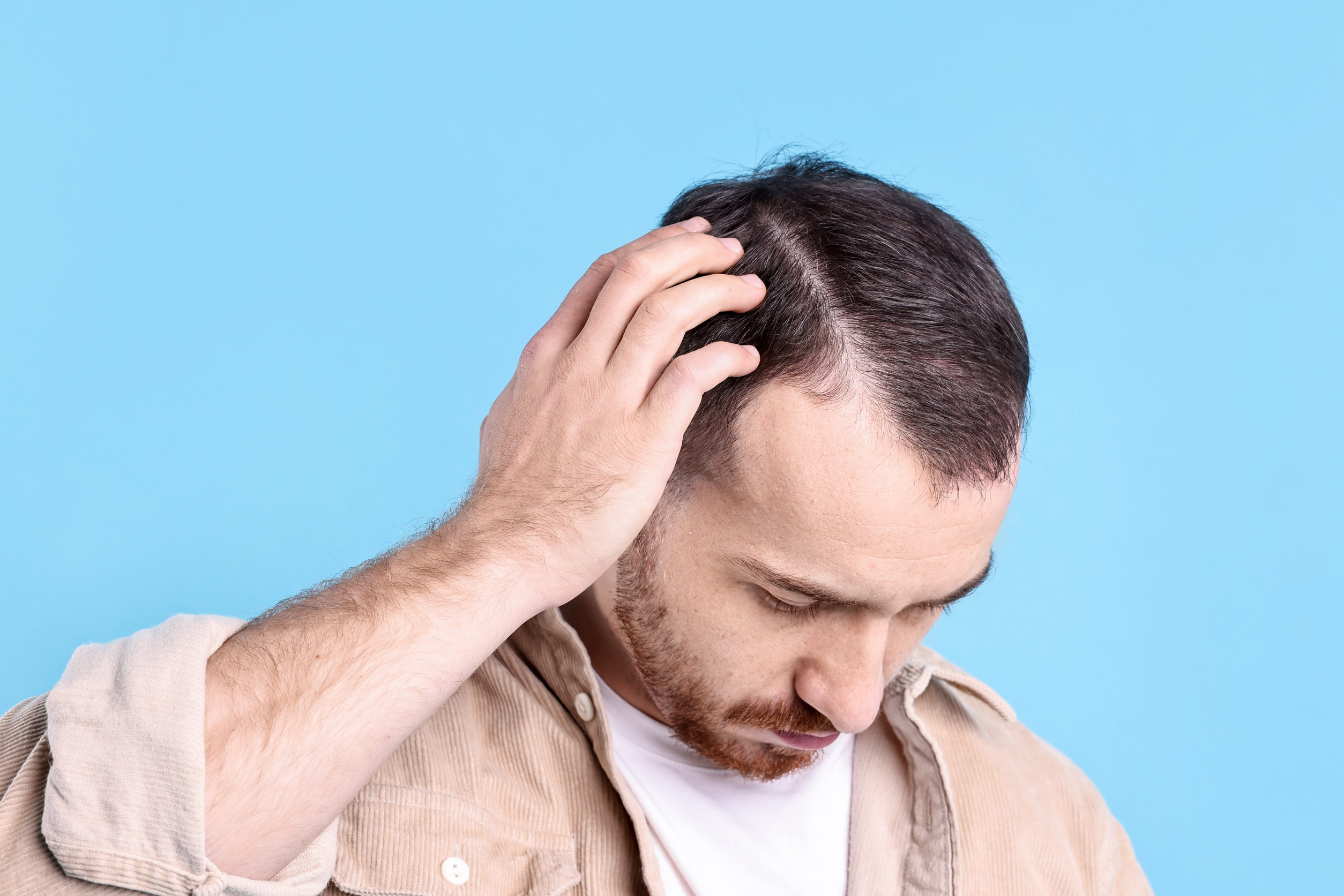 Un uomo preoccupato dalle controindicazioni del trapianto dei capelli