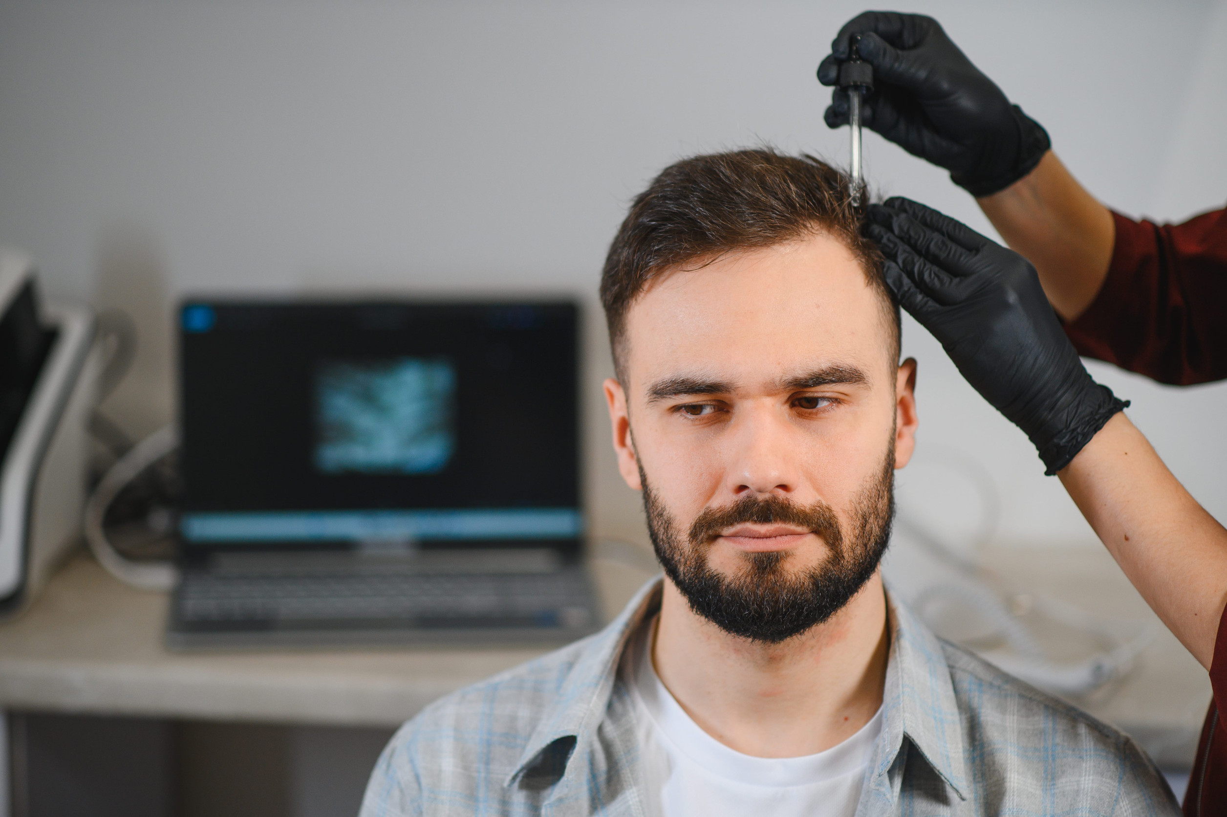 Una fase preparatoria di un trapianto di capelli a Napoli