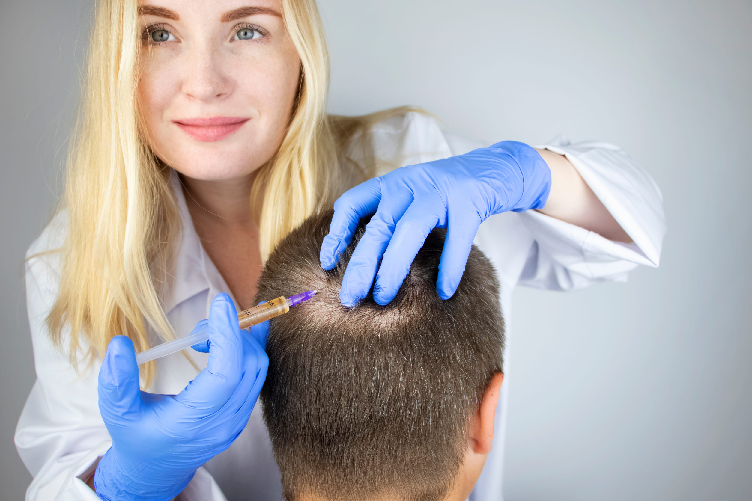 L'anestesia prima di un trapianto di capelli