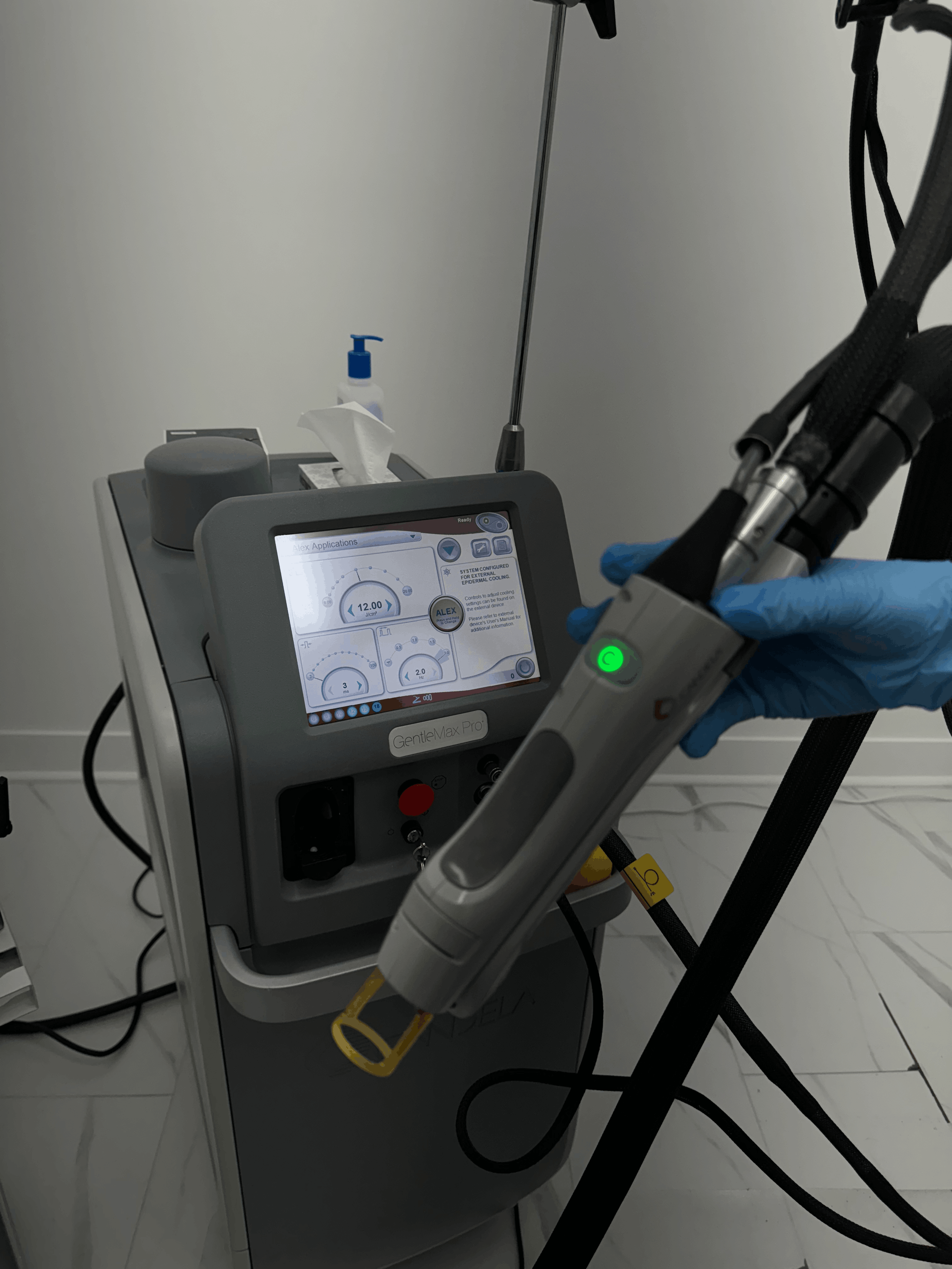 Image of Laser for pigmentation machine