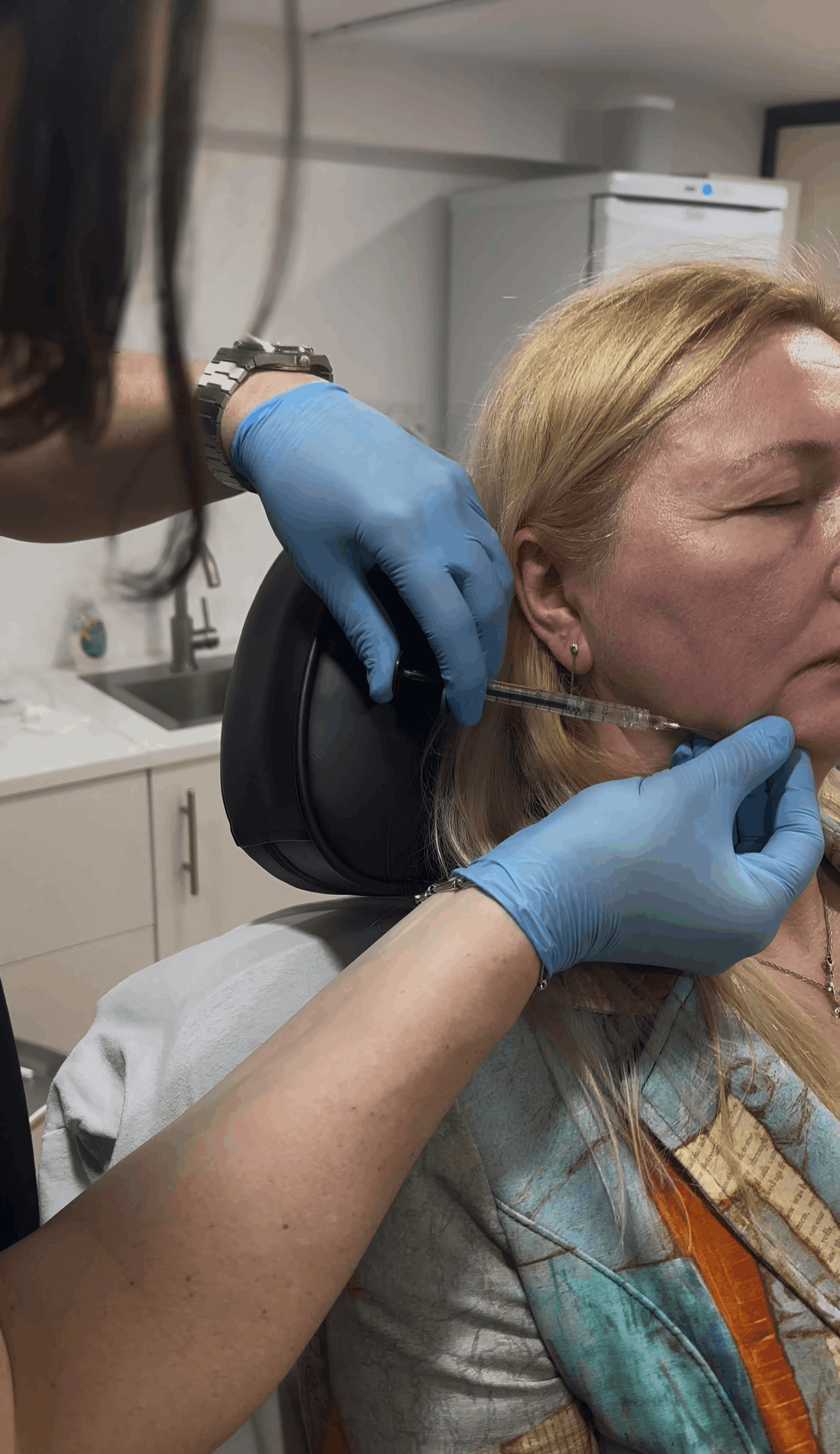 Image of Derma Filler treatment